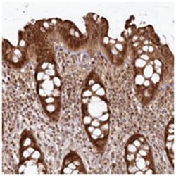 FAM179A, Rabbit, Polyclonal Antibody, Abnova 100 &mu;L | Buy Online | Abnova Corporation | Fisher Scientific