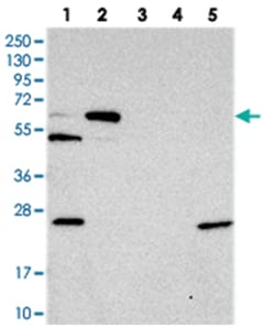 C10orf33, Rabbit, Polyclonal Antibody, Abnova 100 &mu;L | Buy Online | Abnova Corporation | Fisher Scientific
