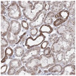 ATAD1, Rabbit, Polyclonal Antibody, Abnova 100 &mu;L | Buy Online | Abnova Corporation | Fisher Scientific