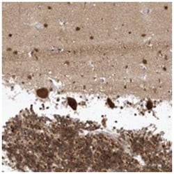 FAM168A, Rabbit, Polyclonal Antibody, Abnova 100&mu;L; Unlabeled:Antibodies,