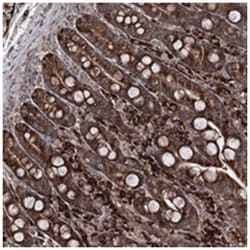 RGNEF, Rabbit, Polyclonal Antibody, Abnova 100 &mu;L | Buy Online | Abnova Corporation | Fisher Scientific