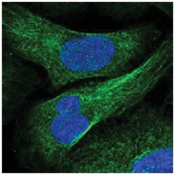 RGNEF, Rabbit, Polyclonal Antibody, Abnova 100 &mu;L | Buy Online | Abnova Corporation | Fisher Scientific