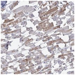 C11orf21, Rabbit, Polyclonal Antibody, Abnova 100 &mu;L | Buy Online | Abnova Corporation | Fisher Scientific