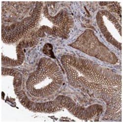 C10orf26, Rabbit, Polyclonal Antibody, Abnova 100 &mu;L | Buy Online | Abnova Corporation | Fisher Scientific