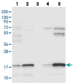 C10orf32, Rabbit, Polyclonal Antibody, Abnova 100 &mu;L | Buy Online | Abnova Corporation | Fisher Scientific