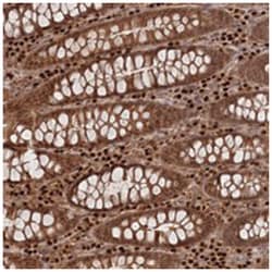 C10orf32, Rabbit, Polyclonal Antibody, Abnova 100 &mu;L | Buy Online | Abnova Corporation | Fisher Scientific