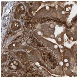 AVPI1, Rabbit, Polyclonal Antibody, Abnova 100&mu;L; Unlabeled:Antibodies,