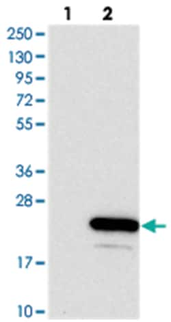 AVPI1, Rabbit, Polyclonal Antibody, Abnova 100&mu;L; Unlabeled:Antibodies,