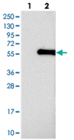 ABHD8 Rabbit anti-Human, Polyclonal Antibody, Abnova 100 &mu;L | Buy Online | Abnova Corporation | Fisher Scientific