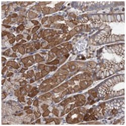 LRCH4 Rabbit anti-Human, Polyclonal Antibody, Abnova 100&mu;L; Unlabeled:Antibodies,