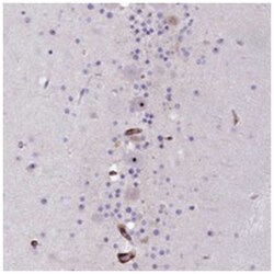 SH3TC2, Rabbit, Polyclonal Antibody, Abnova 100 &mu;L | Buy Online | Abnova Corporation | Fisher Scientific