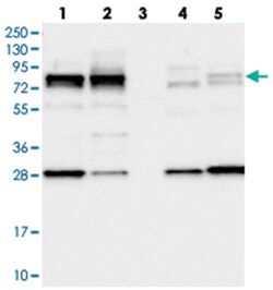 LSG1, Rabbit, Polyclonal Antibody, Abnova 100 &mu;L | Buy Online | Abnova Corporation | Fisher Scientific