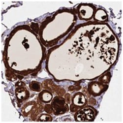 ACOT12 Rabbit anti-Human, Polyclonal Antibody, Abnova 100 &mu;L | Buy Online | Abnova Corporation | Fisher Scientific