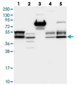 FAM53B, Rabbit, Polyclonal Antibody, Abnova 100 &mu;L | Buy Online | Abnova Corporation | Fisher Scientific