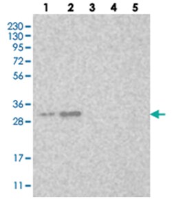LOC153364, Rabbit, Polyclonal Antibody, Abnova 100 &mu;L | Buy Online | Abnova Corporation | Fisher Scientific