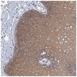 LOC153364, Rabbit, Polyclonal Antibody, Abnova 100 &mu;L | Buy Online | Abnova Corporation | Fisher Scientific