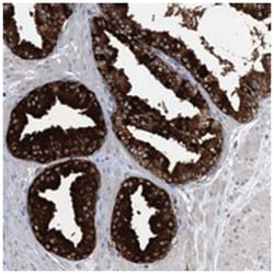 C5orf44, Rabbit, Polyclonal Antibody, Abnova 100&mu;L; Unlabeled:Antibodies,