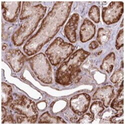 PSTK, Rabbit, Polyclonal Antibody, Abnova 100&mu;L; Unlabeled:Antibodies,