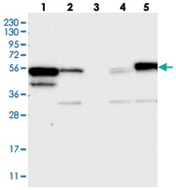 KBTBD4, Rabbit, Polyclonal Antibody, Abnova 100&mu;L; Unlabeled:Antibodies,