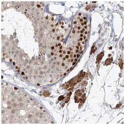 KBTBD4, Rabbit, Polyclonal Antibody, Abnova 100&mu;L; Unlabeled:Antibodies,