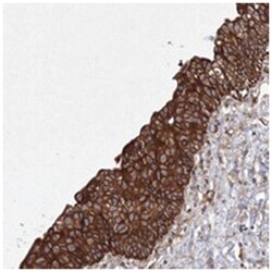 SNX18, Rabbit, Polyclonal Antibody, Abnova 100&mu;L; Unlabeled:Antibodies,