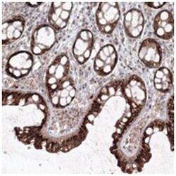 C10orf104, Rabbit, Polyclonal Antibody, Abnova 100 &mu;L | Buy Online | Abnova Corporation | Fisher Scientific