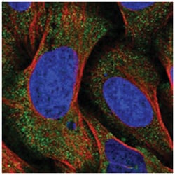 C10orf104, Rabbit, Polyclonal Antibody, Abnova 100 &mu;L | Buy Online | Abnova Corporation | Fisher Scientific