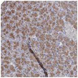 ARMC3, Rabbit, Polyclonal Antibody, Abnova 100 &mu;L | Buy Online | Abnova Corporation | Fisher Scientific