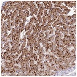 BEND7, Rabbit, Polyclonal Antibody, Abnova 100 &mu;L | Buy Online | Abnova Corporation | Fisher Scientific