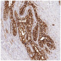 AFAP1L2 Rabbit anti-Human, Polyclonal Antibody, Abnova 100 &mu;L | Buy Online | Abnova Corporation | Fisher Scientific