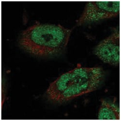 STOX1 Rabbit anti-Human, Polyclonal Antibody, Abnova 100 &mu;L | Buy Online | Abnova Corporation | Fisher Scientific