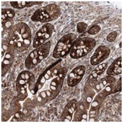 VWA2, Rabbit, Polyclonal Antibody, Abnova 100 &mu;L | Buy Online | Abnova Corporation | Fisher Scientific