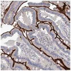 MAP9, Rabbit, Polyclonal Antibody, Abnova 100 &mu;L | Buy Online | Abnova Corporation | Fisher Scientific
