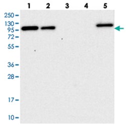 COPG, Rabbit, Polyclonal Antibody, Abnova 100&mu;L; Unlabeled:Antibodies,