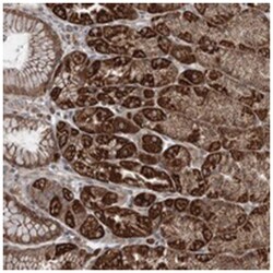 TTC37, Rabbit, Polyclonal Antibody, Abnova 100 &mu;L | Buy Online | Abnova Corporation | Fisher Scientific