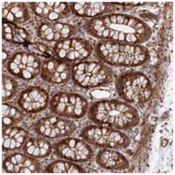 POLR3A Rabbit anti-Human, Polyclonal Antibody, Abnova 100 &mu;L | Buy Online | Abnova Corporation | Fisher Scientific