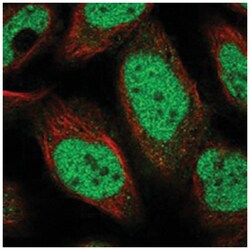 POLR3A Rabbit anti-Human, Polyclonal Antibody, Abnova 100 &mu;L | Buy Online | Abnova Corporation | Fisher Scientific