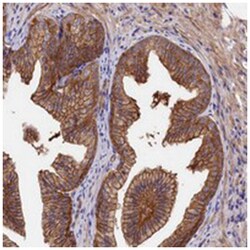 TNKS1BP1, Rabbit, Polyclonal Antibody, Abnova 100&mu;L; Unlabeled:Antibodies,