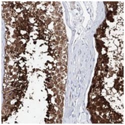 C10orf53, Rabbit, Polyclonal Antibody, Abnova 100 &mu;L | Buy Online | Abnova Corporation | Fisher Scientific