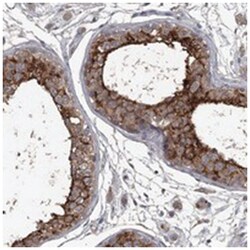 FLVCR2, Rabbit, Polyclonal Antibody, Abnova 100&mu;L; Unlabeled:Antibodies,
