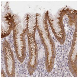 MAP6D1, Rabbit, Polyclonal Antibody, Abnova 100 &mu;L | Buy Online | Abnova Corporation | Fisher Scientific