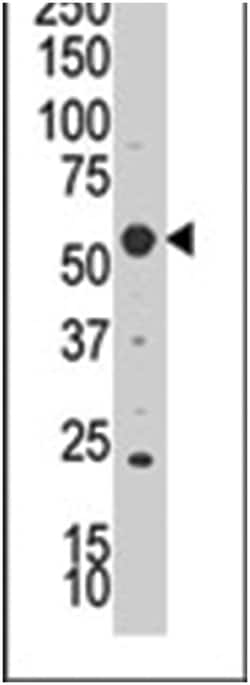 SGK3 Rabbit anti-Human, Polyclonal Antibody, Abnova 400&mu;L; Unlabeled:Antibodies,