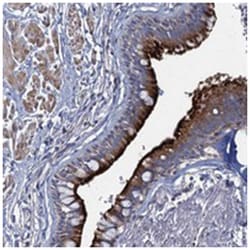 AGBL4 Rabbit anti-Human, Polyclonal Antibody, Abnova 100 &mu;L | Buy Online | Abnova Corporation | Fisher Scientific