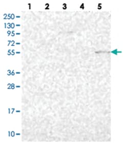 PSAPL1, Rabbit, Polyclonal Antibody, Abnova 100 &mu;L | Buy Online | Abnova Corporation | Fisher Scientific