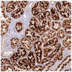 PSAPL1, Rabbit, Polyclonal Antibody, Abnova 100 &mu;L | Buy Online | Abnova Corporation | Fisher Scientific