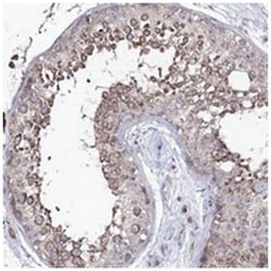 PUS3, Rabbit, Polyclonal Antibody, Abnova 100 &mu;L | Buy Online | Abnova Corporation | Fisher Scientific