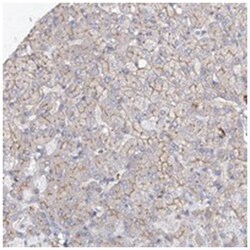 FAM208B Rabbit anti-Human, Polyclonal Antibody, Abnova 100&mu;L; Unlabeled:Antibodies,