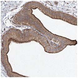 SH3BP5L, Rabbit, Polyclonal Antibody, Abnova 100&mu;L; Unlabeled:Antibodies,