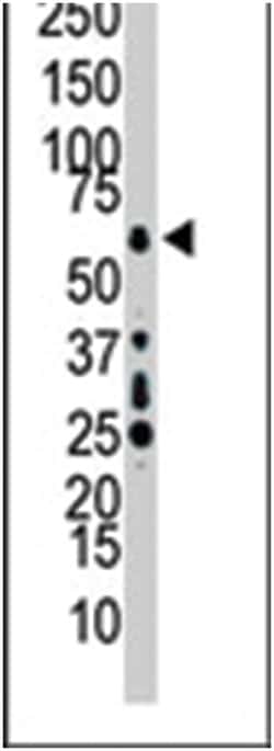 MAP3K7 Rabbit anti-Human, Polyclonal Antibody, Abnova 400 &mu;L | Buy Online | Abnova Corporation | Fisher Scientific