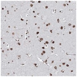 C22orf9, Rabbit, Polyclonal Antibody, Abnova 100&mu;L; Unlabeled:Antibodies,